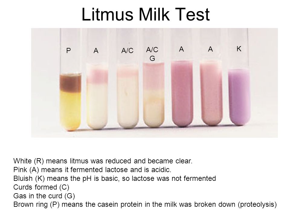 Test de lactulosa para sobrecrecimiento bacteriano